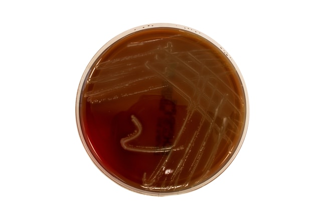 Schaedler Anaerobes Agar mit Schafblut,